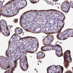 ADAM12 Antibody in Immunohistochemistry (Paraffin) (IHC (P))