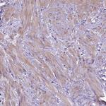 ADAM12 Antibody in Immunohistochemistry (Paraffin) (IHC (P))