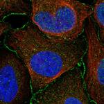 ARMC12 Polyclonal Antibody
