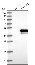 ARMC12 Antibody in Western Blot (WB)