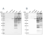 Albumin Antibody in Western Blot (WB)