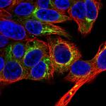 Albumin Polyclonal Antibody