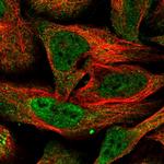 BTRC Polyclonal Antibody