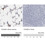 CD41 Antibody in Immunohistochemistry (Paraffin) (IHC (P))