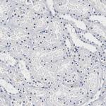 CD41 Antibody in Immunohistochemistry (Paraffin) (IHC (P))