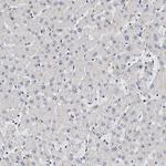 CD41 Antibody in Immunohistochemistry (Paraffin) (IHC (P))
