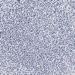 CD41 Antibody in Immunohistochemistry (Paraffin) (IHC (P))