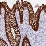 Galectin 4 Antibody in Immunohistochemistry (Paraffin) (IHC (P))