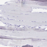 Galectin 4 Antibody in Immunohistochemistry (Paraffin) (IHC (P))