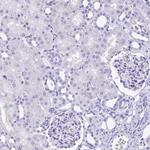 Galectin 4 Antibody in Immunohistochemistry (Paraffin) (IHC (P))