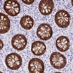 Galectin 4 Antibody in Immunohistochemistry (Paraffin) (IHC (P))