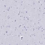 Galectin 4 Antibody in Immunohistochemistry (Paraffin) (IHC (P))