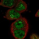 SART1 Polyclonal Antibody