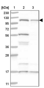 SART1 Antibody in Western Blot (WB)