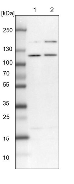 SART1 Antibody in Western Blot (WB)