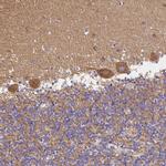 SORL1 Antibody in Immunohistochemistry (Paraffin) (IHC (P))