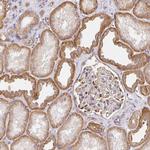 SORL1 Antibody in Immunohistochemistry (Paraffin) (IHC (P))