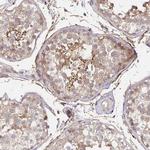 SORL1 Antibody in Immunohistochemistry (Paraffin) (IHC (P))