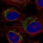 CCR7 Antibody in Immunocytochemistry (ICC/IF)