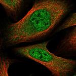 GLMN Antibody in Immunocytochemistry (ICC/IF)