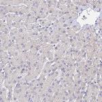 MCM2 Antibody in Immunohistochemistry (Paraffin) (IHC (P))