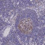 MCM2 Antibody in Immunohistochemistry (Paraffin) (IHC (P))
