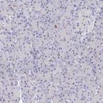MCM2 Antibody in Immunohistochemistry (Paraffin) (IHC (P))