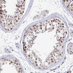 MCM2 Antibody in Immunohistochemistry (Paraffin) (IHC (P))