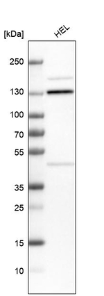 MCM2 Antibody in Western Blot (WB)