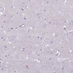 CD40 Antibody in Immunohistochemistry (Paraffin) (IHC (P))