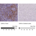 CD40 Antibody in Immunohistochemistry (Paraffin) (IHC (P))
