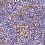 CD40 Antibody in Immunohistochemistry (Paraffin) (IHC (P))