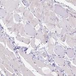 CD40 Antibody in Immunohistochemistry (Paraffin) (IHC (P))