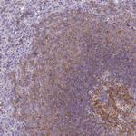 CD40 Antibody in Immunohistochemistry (Paraffin) (IHC (P))
