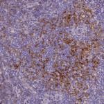 CD40 Antibody in Immunohistochemistry (Paraffin) (IHC (P))