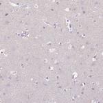 CD40 Antibody in Immunohistochemistry (Paraffin) (IHC (P))