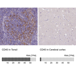 CD40 Antibody in Immunohistochemistry (Paraffin) (IHC (P))
