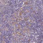 CD40 Antibody in Immunohistochemistry (Paraffin) (IHC (P))
