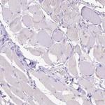 CD40 Antibody in Immunohistochemistry (Paraffin) (IHC (P))