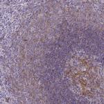 CD40 Antibody in Immunohistochemistry (Paraffin) (IHC (P))