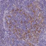 CD40 Antibody in Immunohistochemistry (Paraffin) (IHC (P))