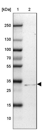 CD40 Antibody in Western Blot (WB)