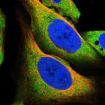 TRPML1 Antibody in Immunocytochemistry (ICC/IF)