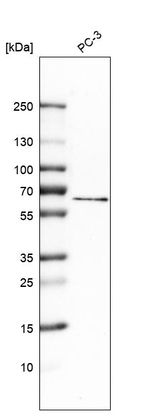 TRPML1 Antibody in Western Blot (WB)