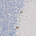 HIC2 Antibody in Immunohistochemistry (Paraffin) (IHC (P))