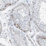 HIC2 Antibody in Immunohistochemistry (Paraffin) (IHC (P))