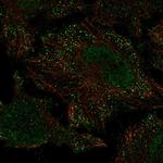 PIEZO2 Polyclonal Antibody