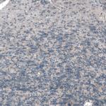 ABCC11 Antibody in Immunohistochemistry (Paraffin) (IHC (P))