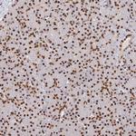 SP3 Polyclonal Antibody