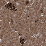 PDE11A Polyclonal Antibody